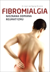 Fibromialgia. Nieznana odmiana reumatyzmu
