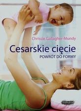 Cesarskie cięcie Powrót do formy