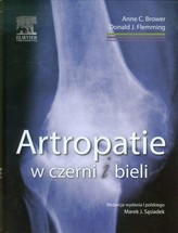 Artropatie w czerni i bieli