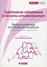 Zakotwienie szkieletowe w leczeniu ortodontycznym