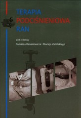 Terapia podciśnieniowa ran