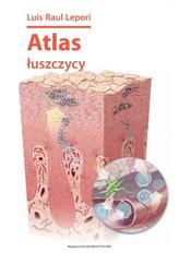 Atlas łuszczycy