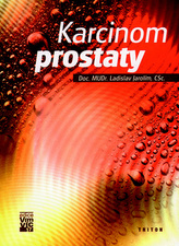 Karcinom prostaty