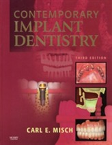  Contemporary Implant Dentistry