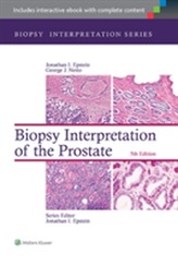  Biopsy Interpretation of the Prostate