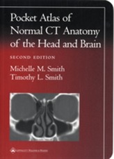  Pocket Atlas of Normal CT Anatomy of the Head and Brain