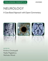  Challenging Concepts in Neurology