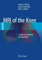  MRI of the Knee