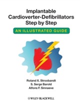  Implantable Cardioverter-defibrillators Step by Step