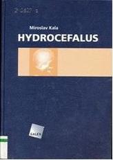 Hydrocefalus