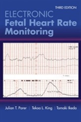  Electronic Fetal Heart Rate Monitoring