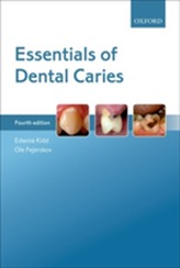  Essentials of Dental Caries