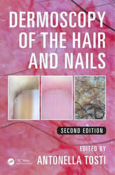  Dermoscopy of the Hair and Nails, Second Edition