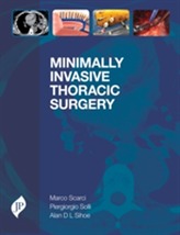  Minimally Invasive Thoracic Surgery