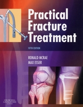  Practical Fracture Treatment