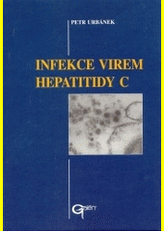 Infekce virem hepatitidy C