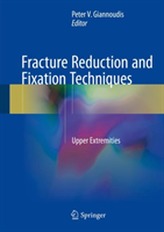  Fracture Reduction and Fixation Techniques