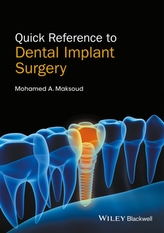  Quick Reference to Dental Implant Surgery