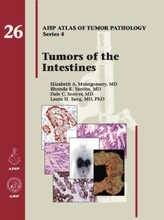  Tumors of the Intestines