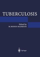  Tuberculosis