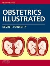  Obstetrics Illustrated