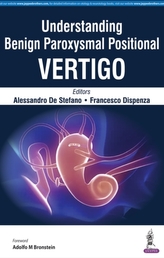  Understanding Benign Paroxysmal Positional Vertigo