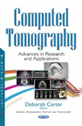  Computed Tomography