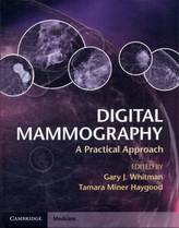  Digital Mammography