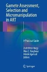  Gamete Assessment, Selection and Micromanipulation in ART