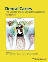  Dental Caries