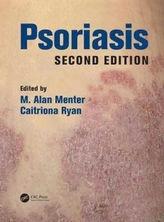  Psoriasis, Second Edition