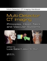  Multi-Detector CT Imaging