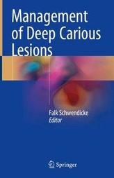  Management of Deep Carious Lesions