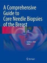 A Comprehensive Guide to Core Needle Biopsies of the Breast