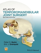  Atlas of Temporomandibular Joint Surgery