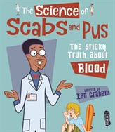 The Science of Scabs & Pus