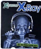  X-Treme X-Ray