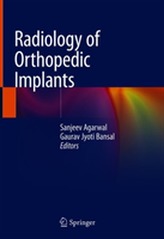  Radiology of Orthopedic Implants