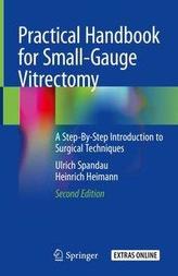 Practical Handbook for Small-Gauge Vitrectomy
