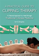  Practical Guide to Cupping Therapy