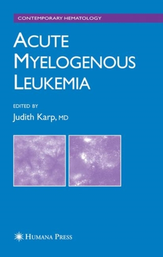 Acute Myelogenous Leukemia  Acute Myelogenous Leukemia