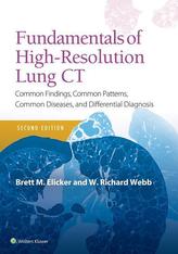  Fundamentals of High-Resolution Lung CT