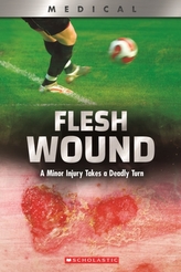  Flesh Wound (XBooks)