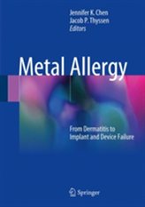  Metal Allergy