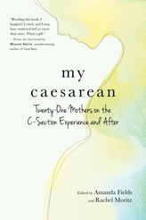  My Caesarean