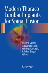  Modern Thoraco-Lumbar Implants for Spinal Fusion