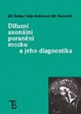 Difuzní axonální poranění mozku a jeho diagnostika