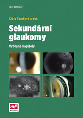 Sekundární glaukomy - Vybrané kapitoly