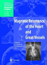 Magnetic Resonance of the Heart and Great Vessels