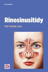 Rinosinusitidy